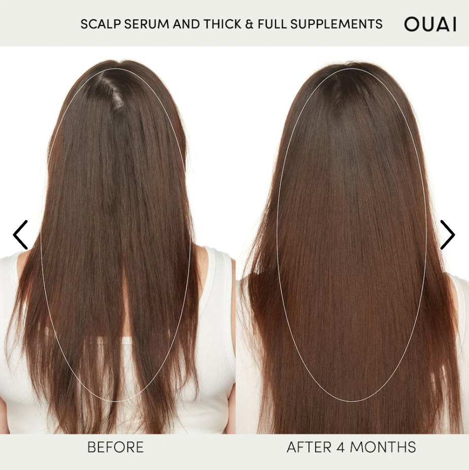 OUAI - Hydrating Scalp Serum for Healthy, Fuller Looking Hair