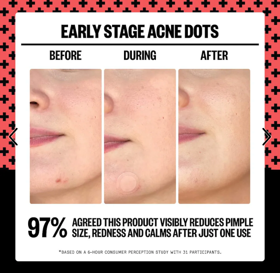 Peace Out - 2% Salicylic Acid Early Stage Acne Dot