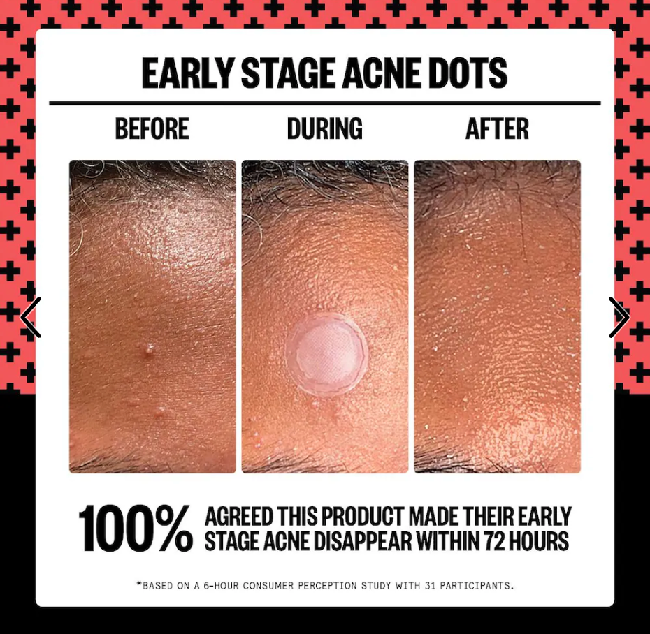 Peace Out - 2% Salicylic Acid Early Stage Acne Dot